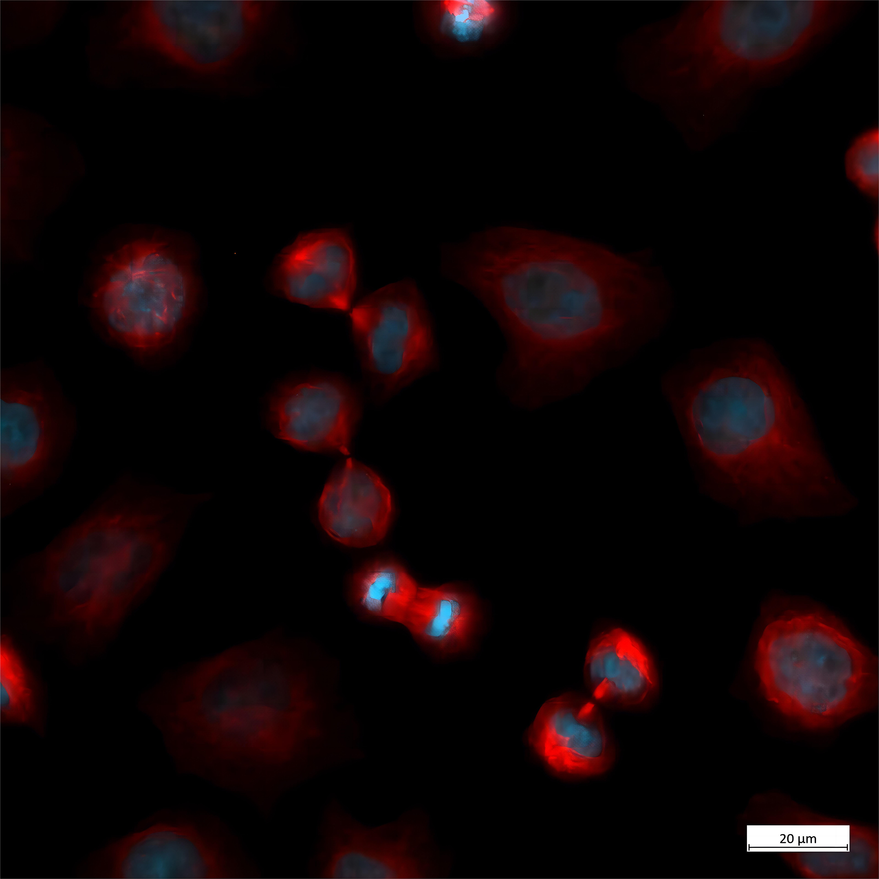 fluorescence_he-la-kyoto-cells_axiovert-5 (1).jpg