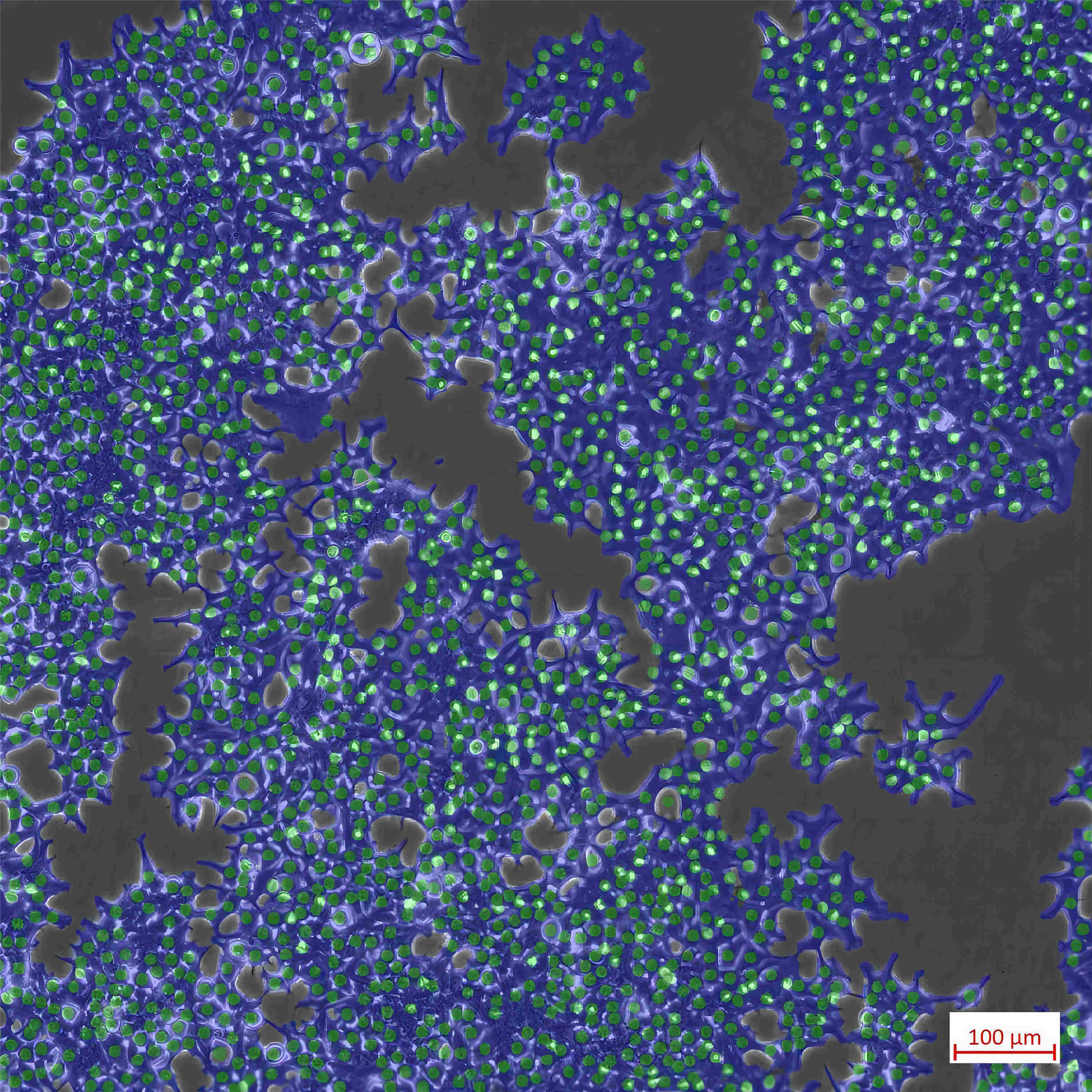 cells_10x_analysis_1x1.jpg